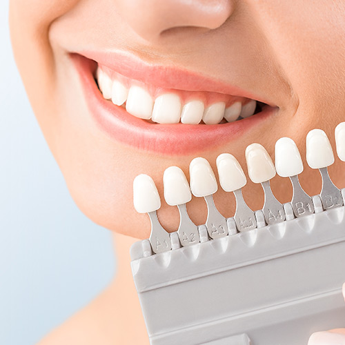 Cosmetic Dentistry