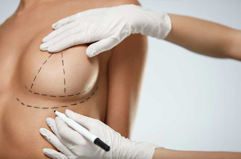 Breast Surgeries