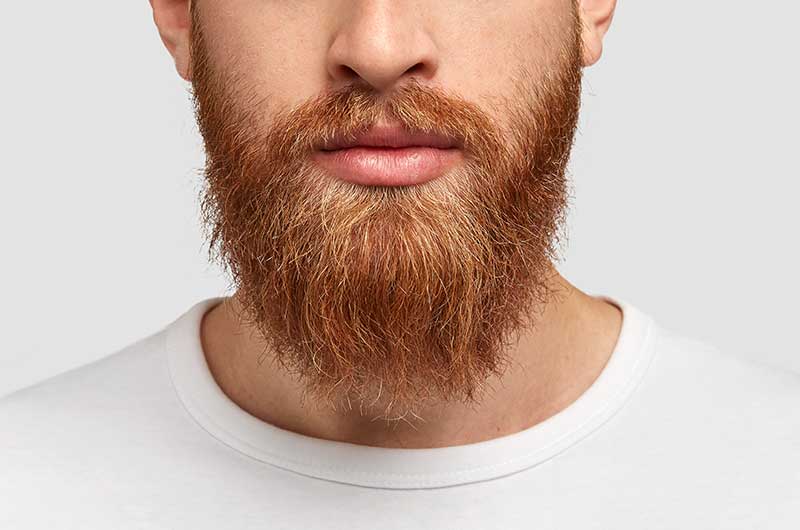 Beard and mustache hair transplant