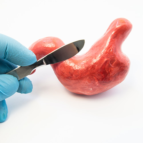 Gastric Operations